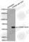Coactivator Associated Arginine Methyltransferase 1 antibody, AP0319, ABclonal Technology, Western Blot image 