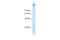 Zinc Finger Protein 318 antibody, 27-621, ProSci, Western Blot image 