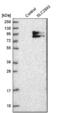 Solute Carrier Family 28 Member 3 antibody, NBP1-84418, Novus Biologicals, Western Blot image 