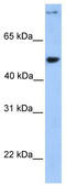 Coiled-Coil Domain Containing 50 antibody, TA337571, Origene, Western Blot image 