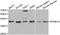 NFKB Inhibitor Alpha antibody, A11397, ABclonal Technology, Western Blot image 