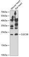 C-Type Lectin Domain Family 3 Member B antibody, GTX32919, GeneTex, Western Blot image 