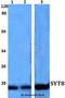 Synaptotagmin 8 antibody, A12547, Boster Biological Technology, Western Blot image 