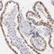 Muscleblind-like protein 3 antibody, NBP1-85635, Novus Biologicals, Immunohistochemistry frozen image 