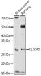 C-Type Lectin Domain Family 4 Member D antibody, GTX53950, GeneTex, Western Blot image 