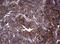 Ribonucleotide Reductase Catalytic Subunit M1 antibody, NBP2-45964, Novus Biologicals, Immunohistochemistry frozen image 