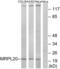 Mitochondrial Ribosomal Protein L20 antibody, abx014085, Abbexa, Western Blot image 