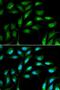 Beta-2-Microglobulin antibody, LS-B15330, Lifespan Biosciences, Immunofluorescence image 