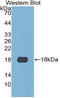 S100 Calcium Binding Protein A3 antibody, LS-C314269, Lifespan Biosciences, Western Blot image 