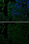 Mesothelin antibody, GTX55703, GeneTex, Immunofluorescence image 