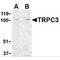 Receptor-activated cation channel TRP3 antibody, MBS150507, MyBioSource, Western Blot image 