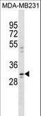 Coiled-Coil Domain Containing 28A antibody, LS-C159288, Lifespan Biosciences, Western Blot image 