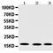 Ubiquitin Conjugating Enzyme E2 I antibody, orb176699, Biorbyt, Western Blot image 