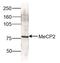 Methyl-CpG Binding Protein 2 antibody, CI1103, Boster Biological Technology, Western Blot image 