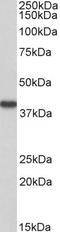 Hydroxyacid Oxidase 2 antibody, STJ73162, St John