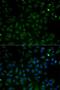 Voltage Dependent Anion Channel 1 antibody, LS-C335108, Lifespan Biosciences, Immunofluorescence image 