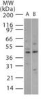 Mitogen-Activated Protein Kinase 11 antibody, GTX13864, GeneTex, Western Blot image 