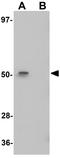 Ectodermal-Neural Cortex 1 antibody, GTX85108, GeneTex, Western Blot image 