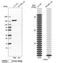 Integrin Subunit Alpha 5 antibody, NBP1-84576, Novus Biologicals, Western Blot image 