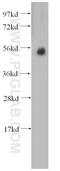 Procollagen C-Endopeptidase Enhancer antibody, 14993-1-AP, Proteintech Group, Western Blot image 