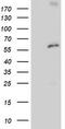 Proteasome 26S Subunit, Non-ATPase 3 antibody, M08767-2, Boster Biological Technology, Western Blot image 