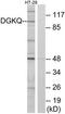 Diacylglycerol Kinase Theta antibody, TA313743, Origene, Western Blot image 