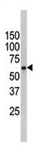 Far Upstream Element Binding Protein 3 antibody, AP11708PU-N, Origene, Western Blot image 