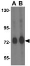 Translocase Of Outer Mitochondrial Membrane 70 antibody, GTX85358, GeneTex, Western Blot image 