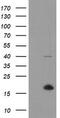 TPD52 Like 3 antibody, M16435, Boster Biological Technology, Western Blot image 