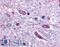 Solute Carrier Family 5 Member 3 antibody, LS-A2816, Lifespan Biosciences, Immunohistochemistry paraffin image 