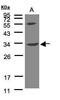 Vacuolar protein sorting-associated protein 37C antibody, TA308195, Origene, Western Blot image 