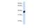 CLN8 Transmembrane ER And ERGIC Protein antibody, GTX46076, GeneTex, Western Blot image 