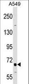 TNF Receptor Superfamily Member 21 antibody, LS-B10688, Lifespan Biosciences, Western Blot image 