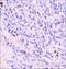 HIF-2-alpha antibody, NBP2-76454, Novus Biologicals, Immunohistochemistry paraffin image 