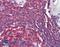 CD20 antibody, LS-B11144, Lifespan Biosciences, Immunohistochemistry paraffin image 