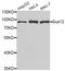 SUZ12 Polycomb Repressive Complex 2 Subunit antibody, STJ27382, St John