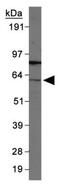 Dual Specificity Tyrosine Phosphorylation Regulated Kinase 2 antibody, GTX48606, GeneTex, Western Blot image 