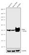 Parkin RBR E3 Ubiquitin Protein Ligase antibody, 702785, Invitrogen Antibodies, Western Blot image 