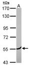 Coronin 2A antibody, NBP2-15966, Novus Biologicals, Western Blot image 