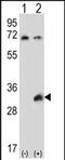 Testis Specific Serine Kinase 6 antibody, PA5-71709, Invitrogen Antibodies, Western Blot image 