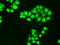 Neurotrophic Receptor Tyrosine Kinase 3 antibody, GTX83977, GeneTex, Immunofluorescence image 