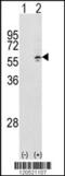 T-complex protein 1 subunit gamma antibody, 61-582, ProSci, Western Blot image 