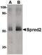 Sprouty Related EVH1 Domain Containing 2 antibody, PA5-20625, Invitrogen Antibodies, Western Blot image 