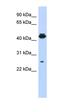 PDLIM1 Interacting Kinase 1 Like antibody, orb330703, Biorbyt, Western Blot image 