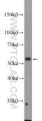 Dyskerin Pseudouridine Synthase 1 antibody, 25420-1-AP, Proteintech Group, Western Blot image 