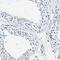 Annexin A3 antibody, HPA013398, Atlas Antibodies, Immunohistochemistry frozen image 
