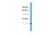 Fibronectin Type III Domain Containing 4 antibody, GTX46001, GeneTex, Western Blot image 