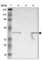 Armadillo Repeat Containing X-Linked 3 antibody, NBP1-89142, Novus Biologicals, Western Blot image 