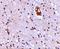 Transmembrane Channel Like 8 antibody, A06892-1, Boster Biological Technology, Immunohistochemistry paraffin image 