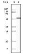 Keratin 1 antibody, LS-C47183, Lifespan Biosciences, Western Blot image 